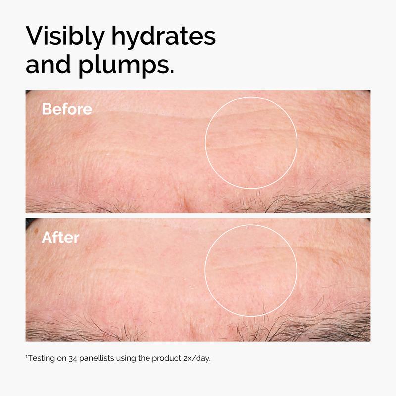 Hyaluronic Acid 2% + B5 (Original Formulation)