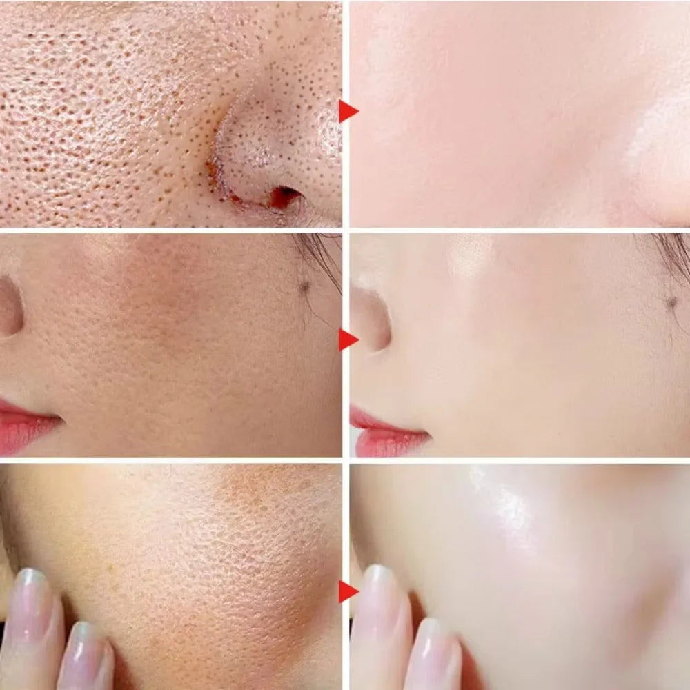Hyaluronic Acid 2% + B5 (Original Formulation)