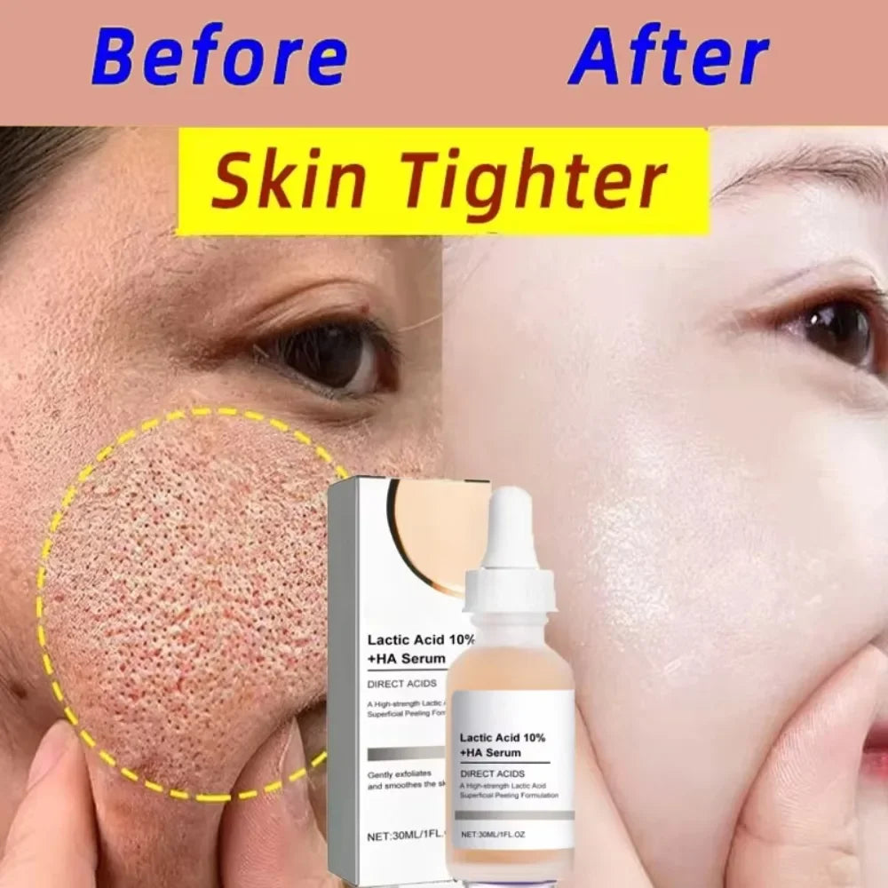 Hyaluronic Acid 2% + B5 (Original Formulation)